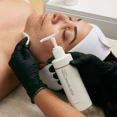 Tuel Post Extraction Solution